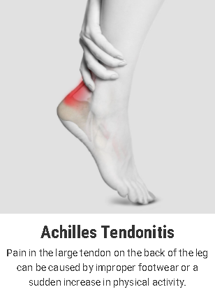 achilles tendonitis Vancouver Orthotics
