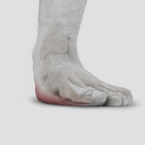 FFF - Flexible Flat Feet - Nev Davies