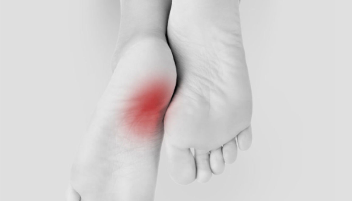 Heel Pain