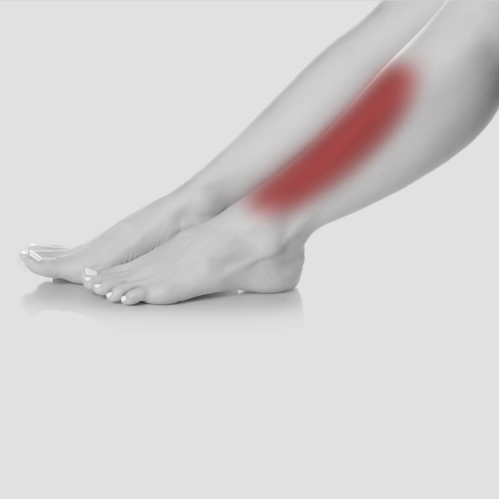 Relief for Shin Splints (Anterior Tibialis Tendonitis) and Sciatica at -  Vancouver Orthotic Clinics