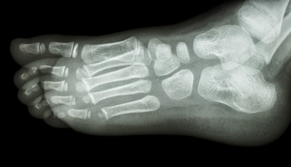 x-ray foot lateral : show normal child's foot