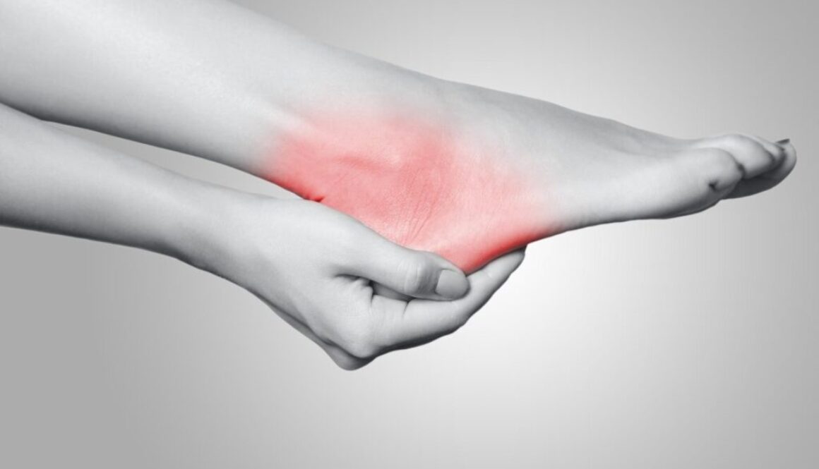 Heel Spurs, Heel Pain, Extended Health Benefits