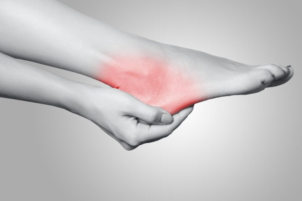 Heel Spurs, Heel Pain, Extended Health Benefits