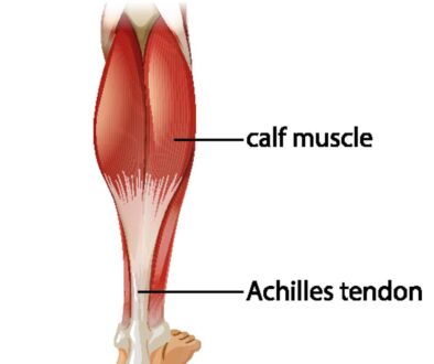 Achilles Tendonitis Pain: Causes, Treatment, and Prevention Explained by Vancouver Orthotic Clinics 