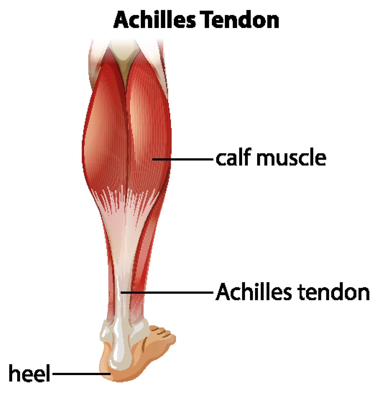 Achilles Tendonitis Pain: Causes, Treatment, and Prevention Explained by Vancouver Orthotic Clinics 