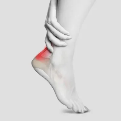 Achilles Tendonitis