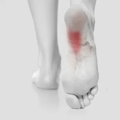 Heel Spurs 